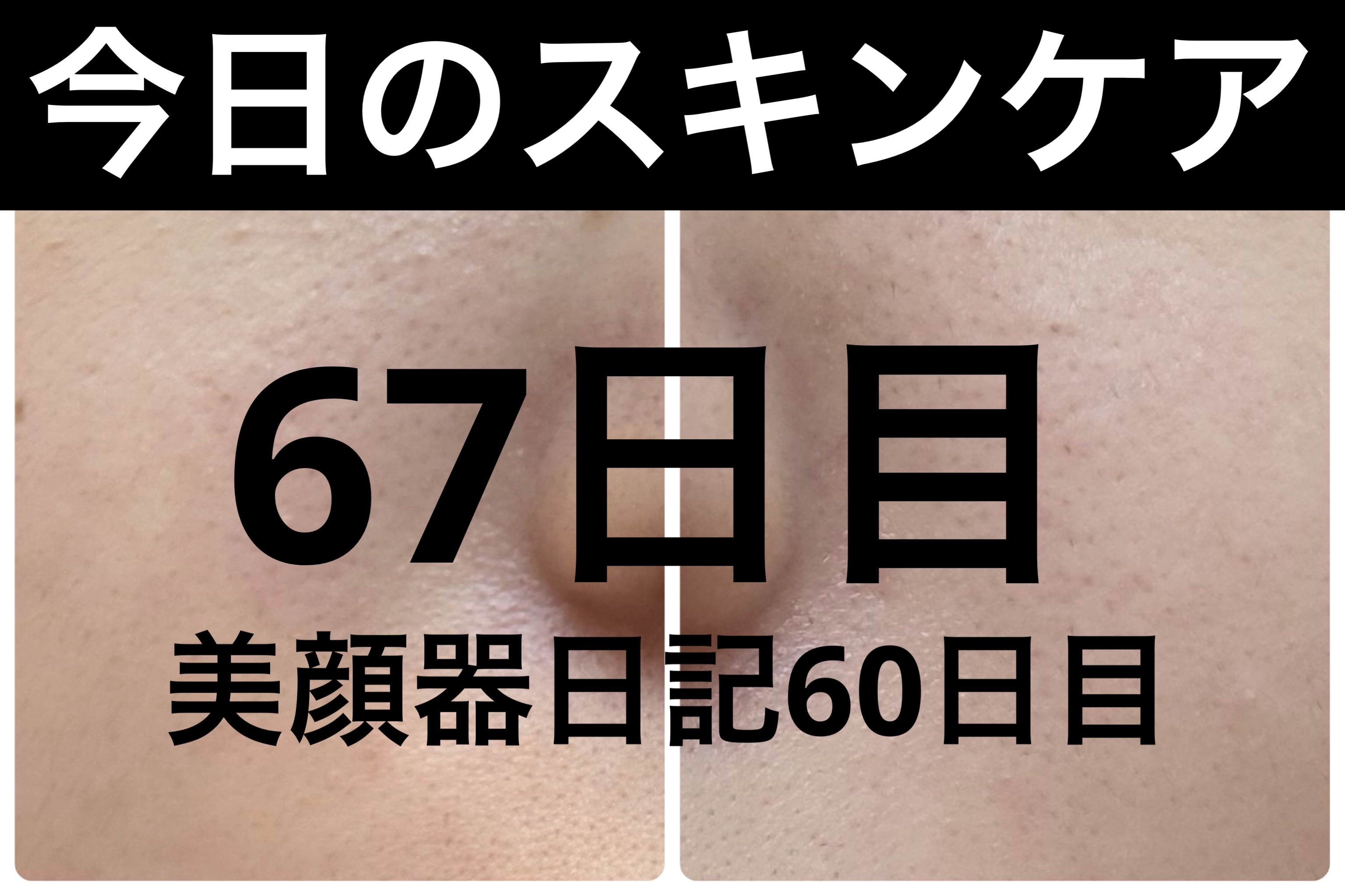 モーニングジェルウォッシュ/ビトレスキン/その他洗顔料を使ったクチコミ（1枚目）