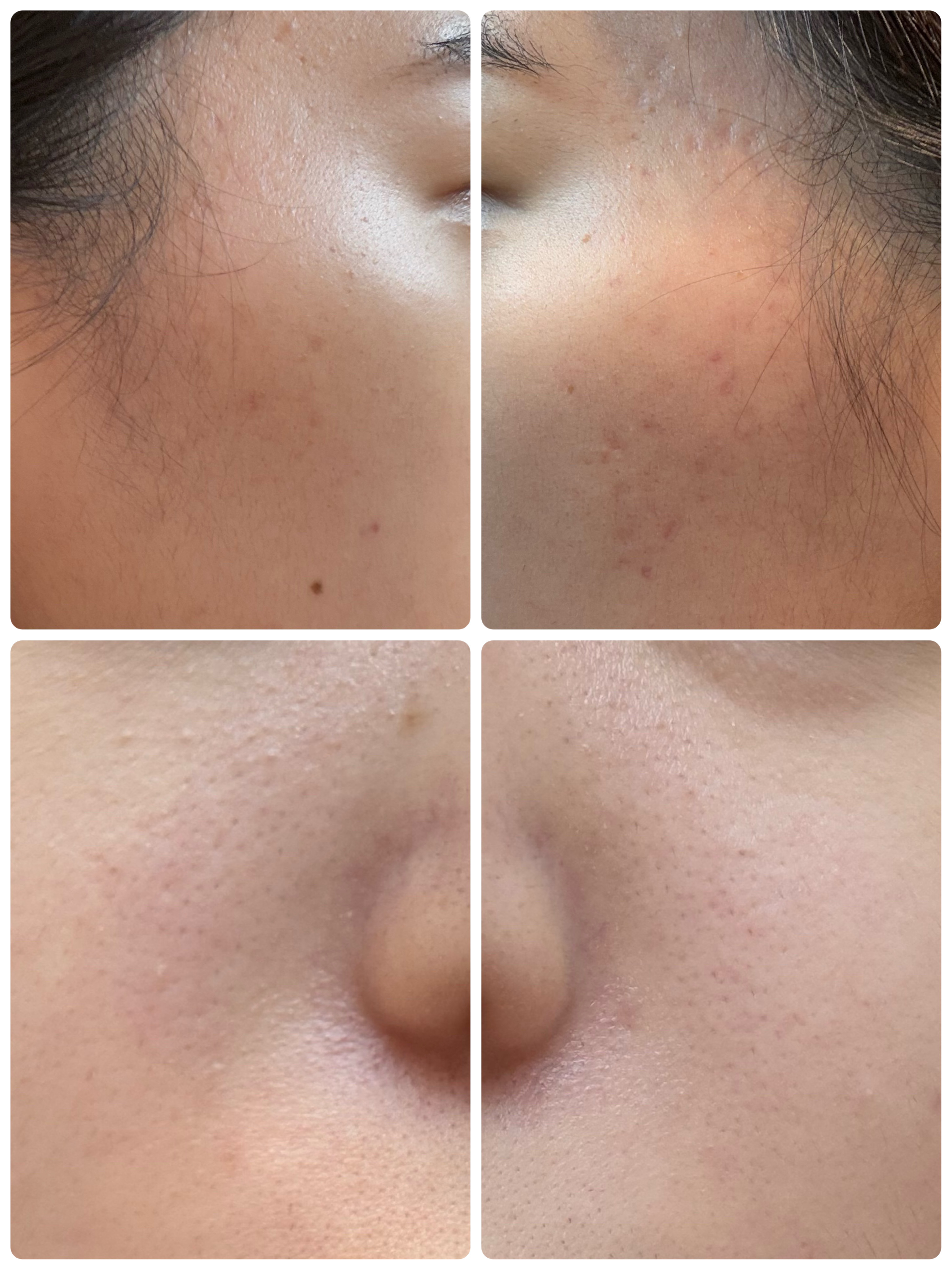 モーニングジェルウォッシュ/ビトレスキン/その他洗顔料を使ったクチコミ（2枚目）