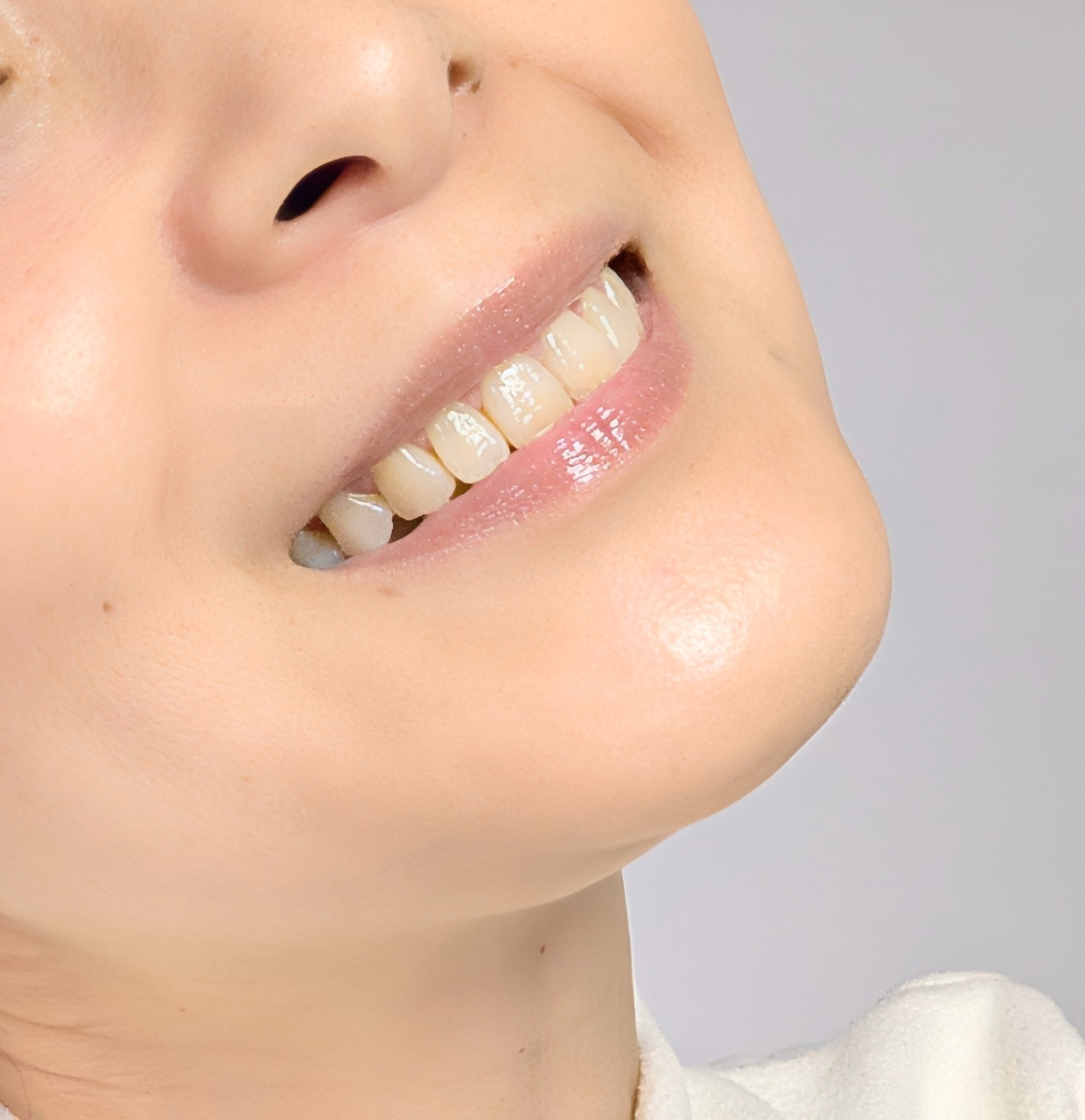 アパデント トータルケア/アパデント/歯磨き粉を使ったクチコミ（2枚目）