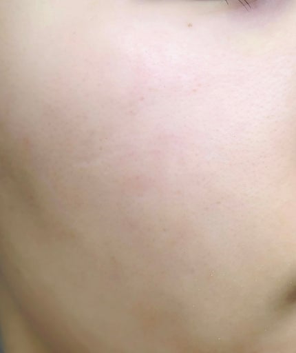 ユルムスキンクリーンパック/RETURNITY/洗い流すパック・マスクを使ったクチコミ(4枚目)