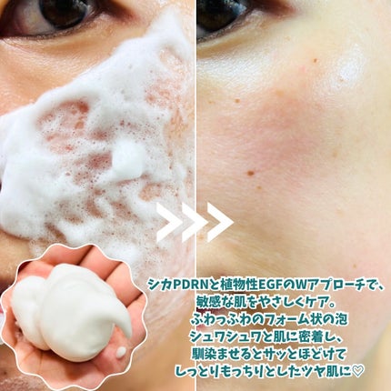 エアバブルCDSマスク トリプルSリペア/GASH/洗い流すパック・マスクを使ったクチコミ(2枚目)