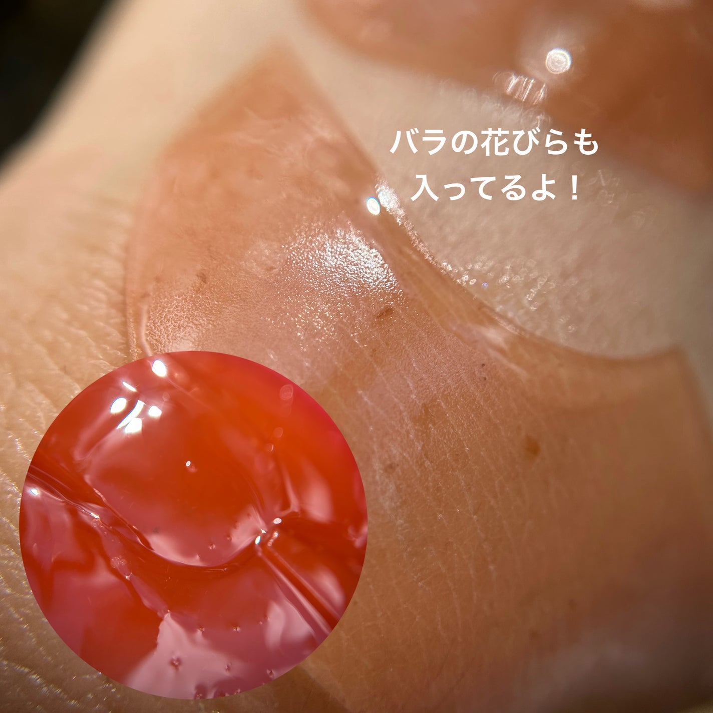 ブレミッシュケアアップ セラム/ISOI/美容液を使ったクチコミ(5枚目)