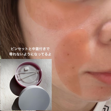 ブレミッシュケアアップ セラム/ISOI/美容液を使ったクチコミ(6枚目)