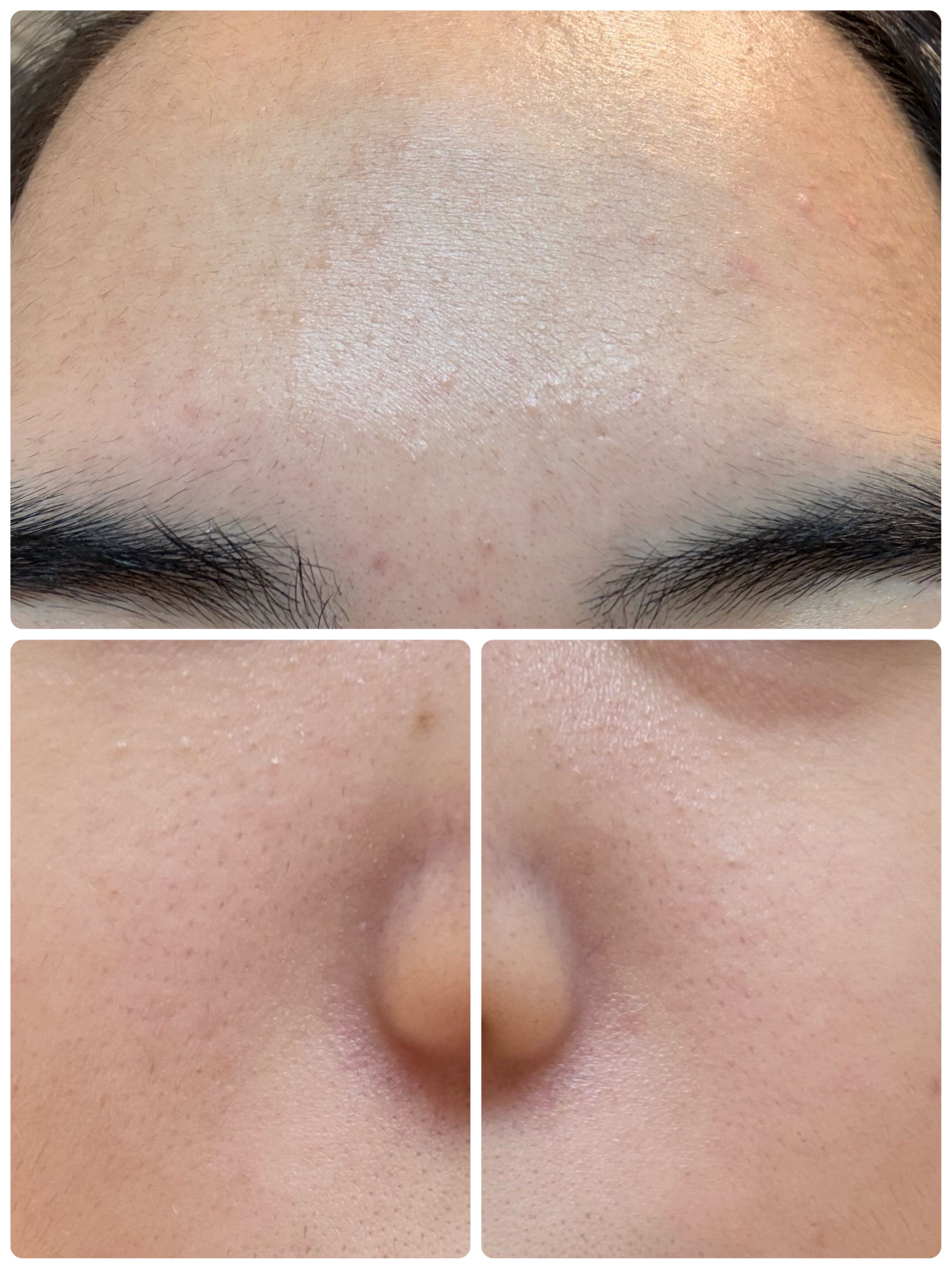 GLAM UP炭酸泡クレイマスク/GLAM UP/洗い流すパック・マスクを使ったクチコミ（3枚目）