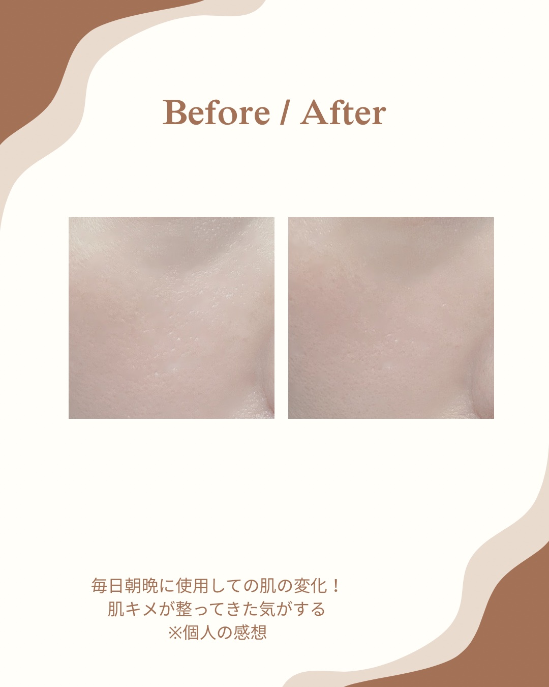 AZケア トナー/VT/化粧水を使ったクチコミ（3枚目）