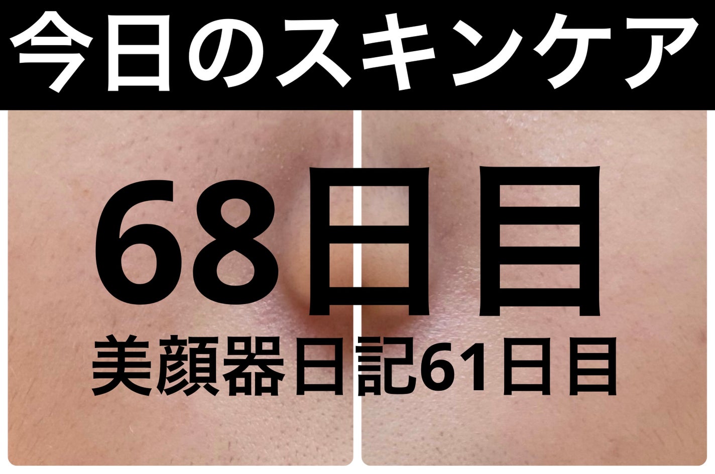 モーニングジェルウォッシュ/ビトレスキン/その他洗顔料を使ったクチコミ(1枚目)