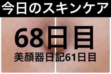 AGE-R ブースタープロ/MEDICUBE/美顔器・マッサージを使ったクチコミ(1枚目)