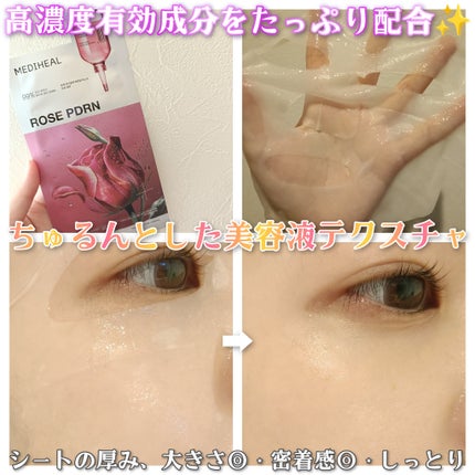ローゼPDRNエッセンシャルマスクヘルシーグロウ/MEDIHEAL/シートマスク・パックを使ったクチコミ(3枚目)