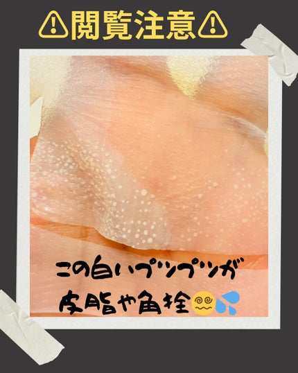 トラブルパッチマスク/EIOM/その他スキンケアを使ったクチコミ(3枚目)