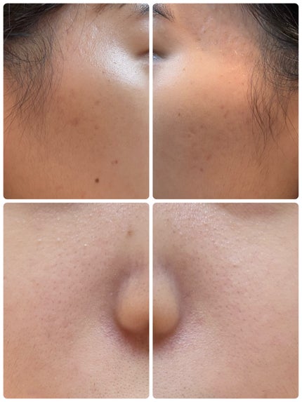 AGE-R ブースタープロ/MEDICUBE/美顔器・マッサージを使ったクチコミ(2枚目)