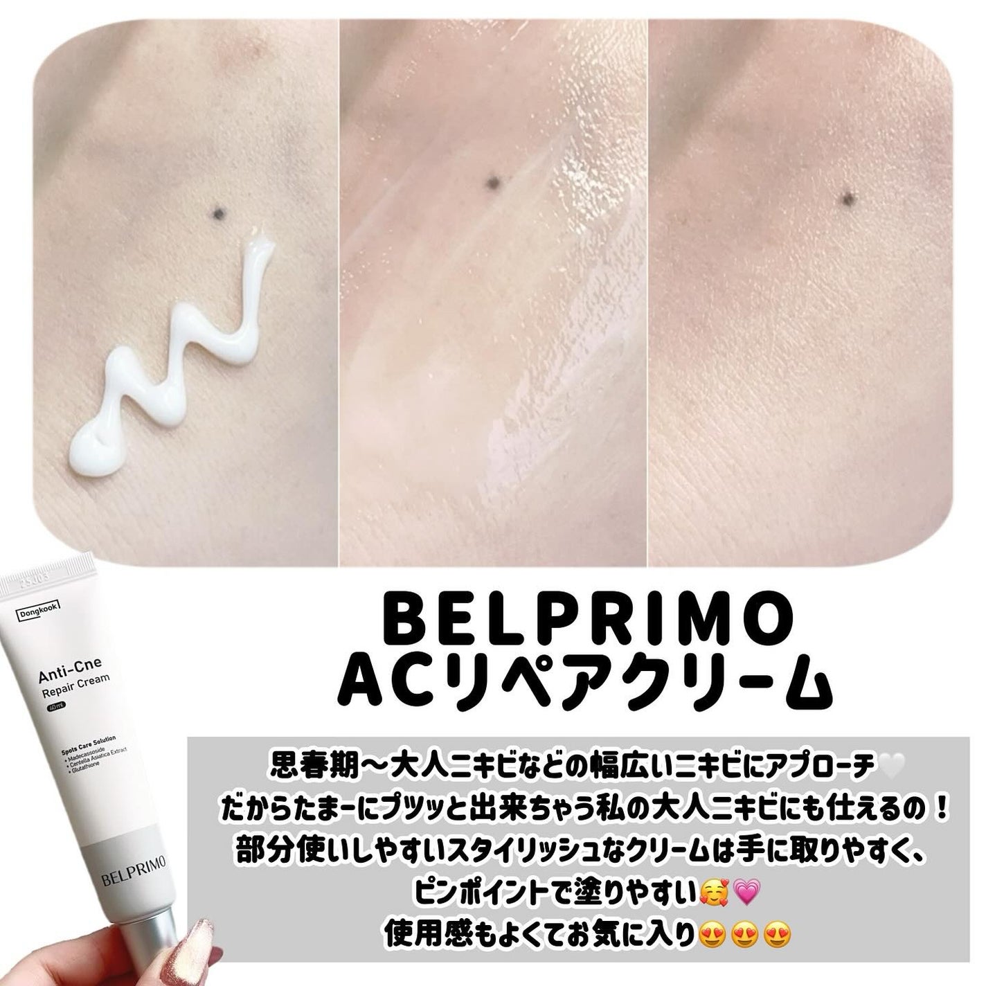 ベルプリモ ACリペアクリーム/BELPRIMO/フェイスクリームを使ったクチコミ(3枚目)