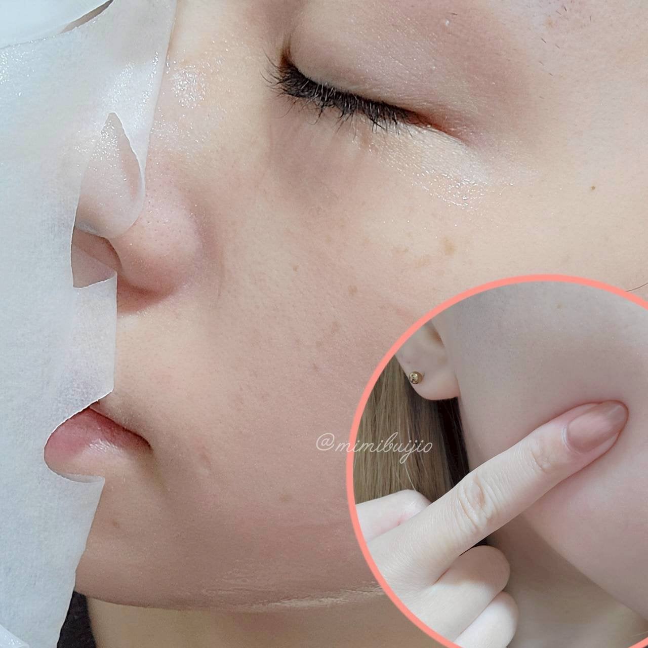 ローゼPDRNエッセンシャルマスクヘルシーグロウ/MEDIHEAL/シートマスク・パックを使ったクチコミ(3枚目)