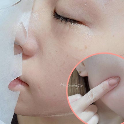 ローゼPDRNエッセンシャルマスクヘルシーグロウ/MEDIHEAL/シートマスク・パックを使ったクチコミ(3枚目)