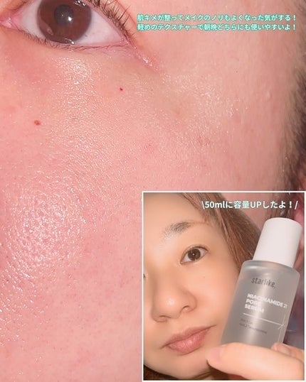 ナイアシンアミド 21 ポアセラム/STARLIKE/美容液を使ったクチコミ(4枚目)