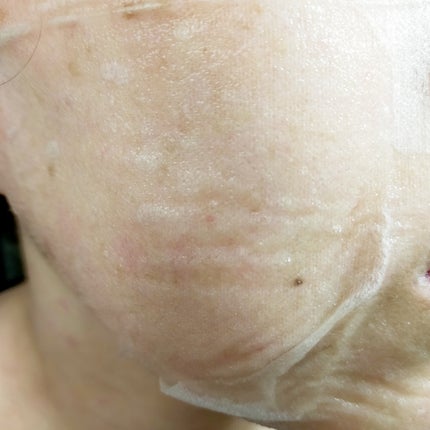 リジュオンリペアエッセンスマスク/ピュレア/シートマスク・パックを使ったクチコミ(2枚目)