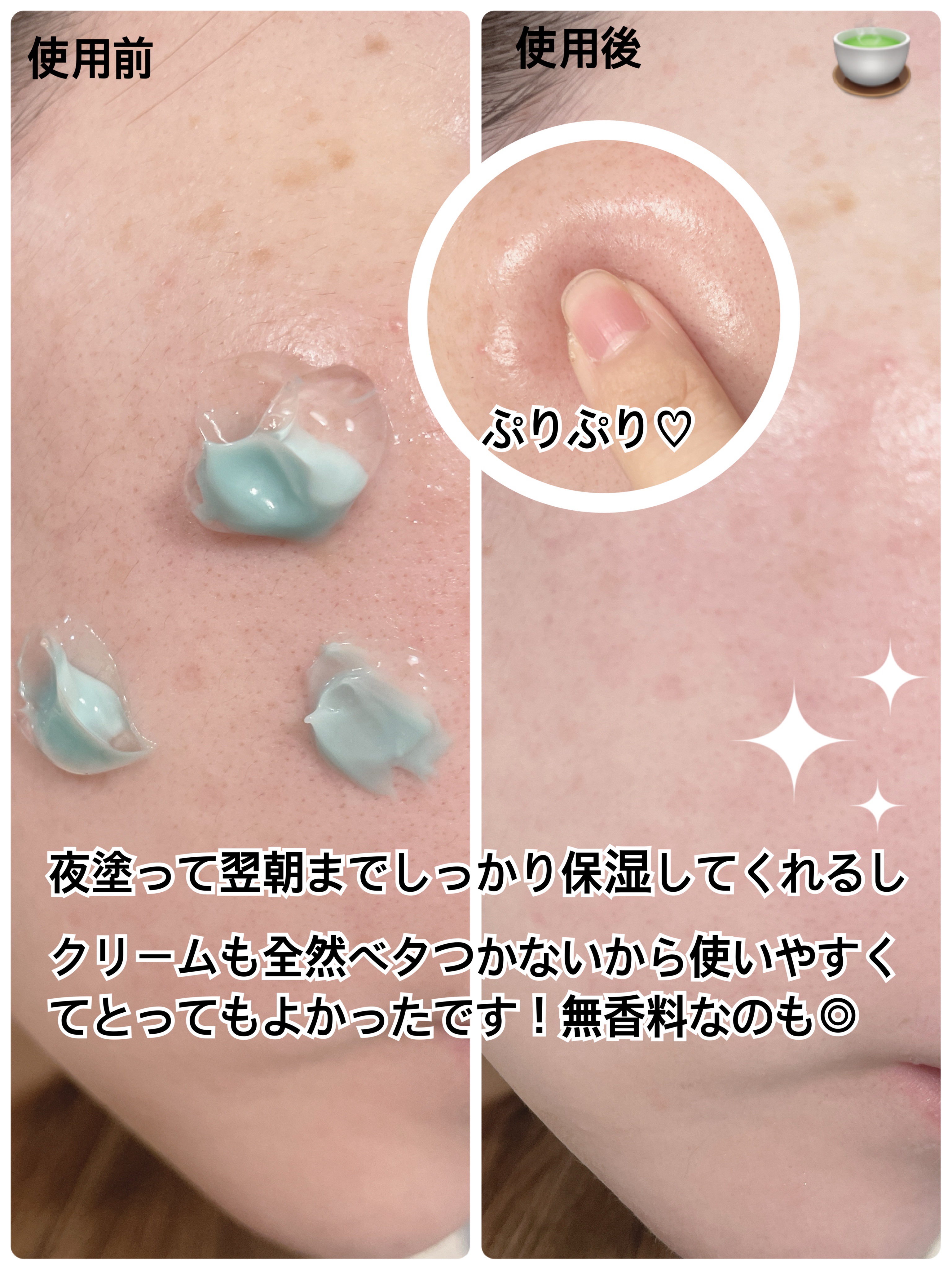 PDRN カプセルクリーム 100/VT/フェイスクリームを使ったクチコミ（3枚目）