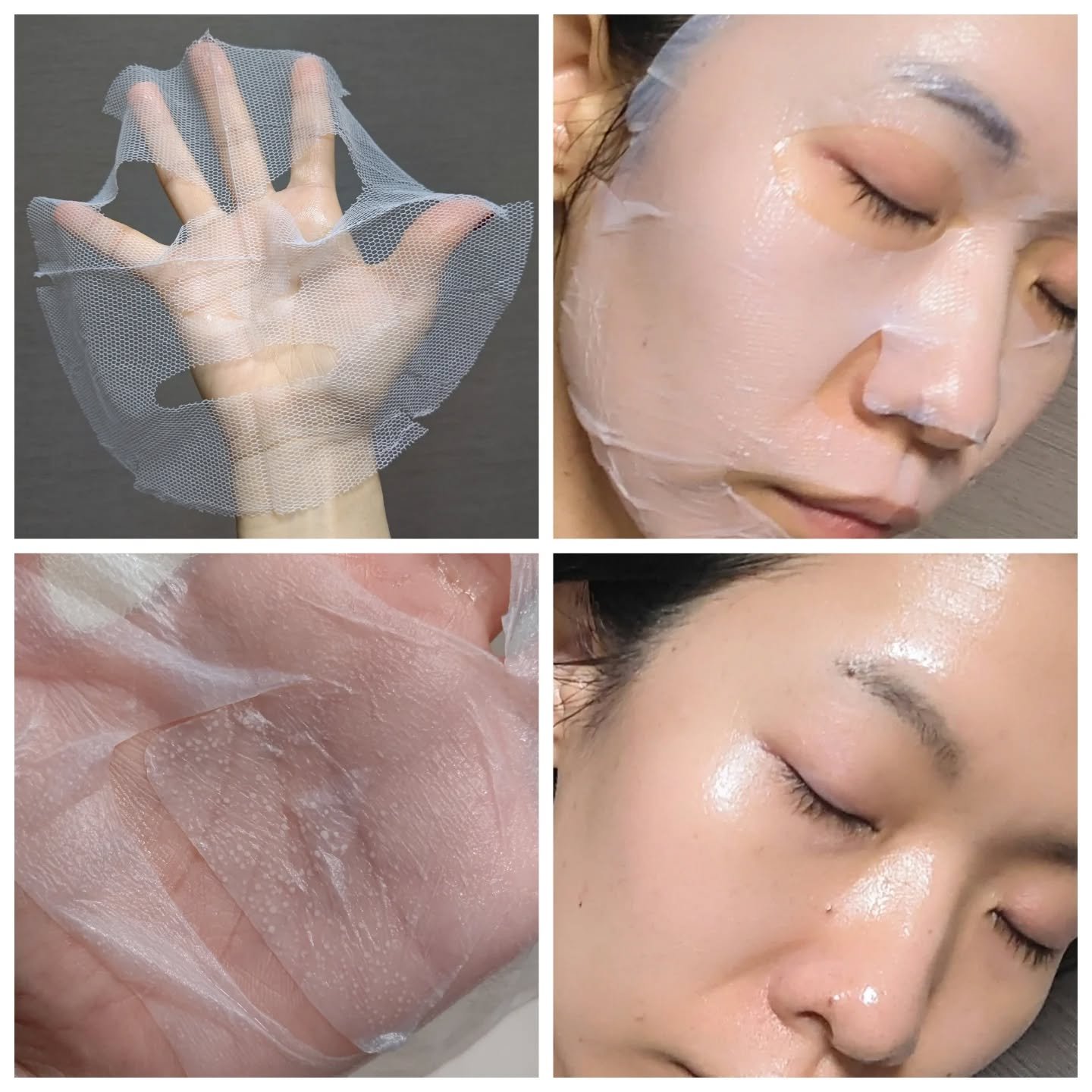 トラブルパッチマスク/EIOM/その他スキンケアを使ったクチコミ（2枚目）