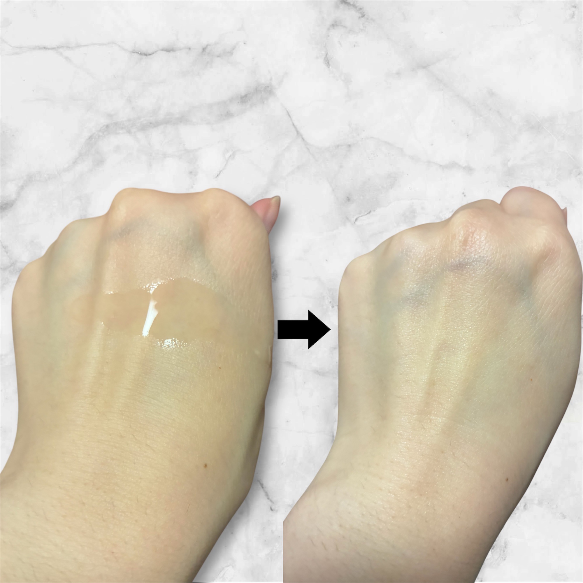 AZケア トナー/VT/化粧水を使ったクチコミ（3枚目）