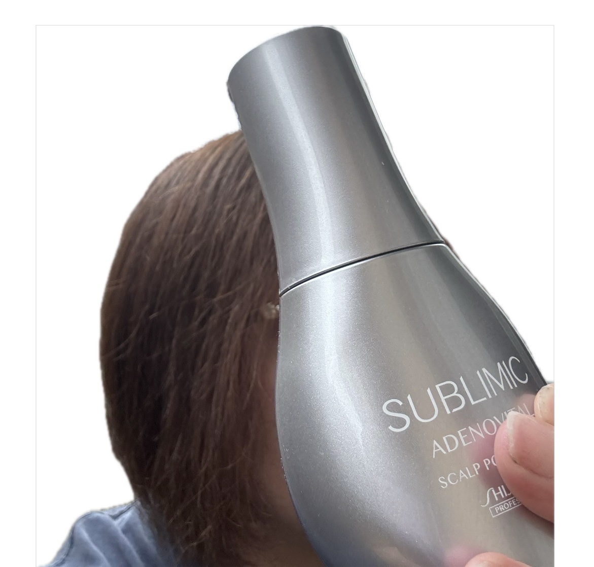 アデノバイタル スカルプ パワーショット/サブリミック/頭皮ローションを使ったクチコミ（1枚目）