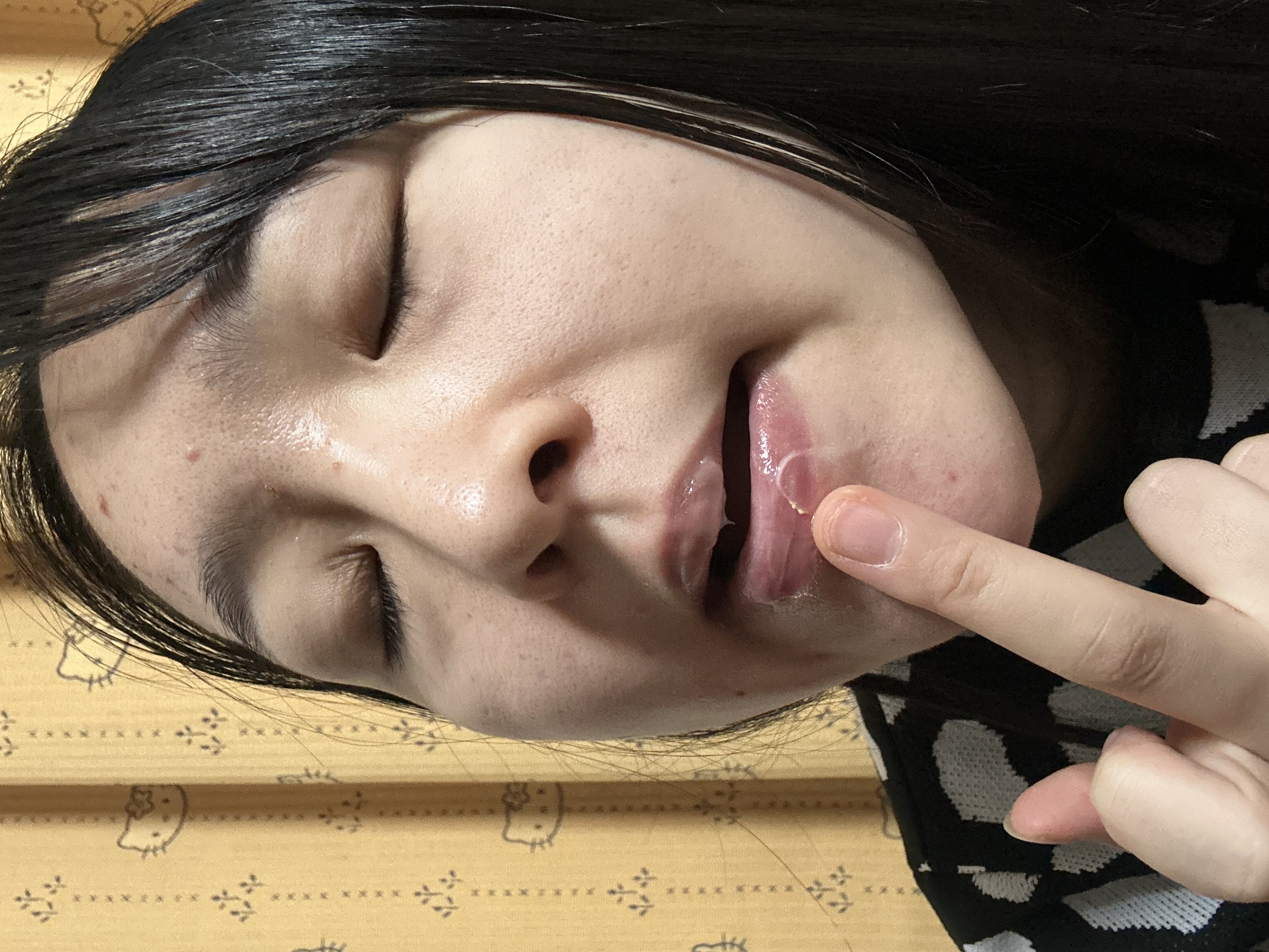 ナイトニードルリップ　ディープモイスト/CHOOSY/リップ美容液を使ったクチコミ（1枚目）