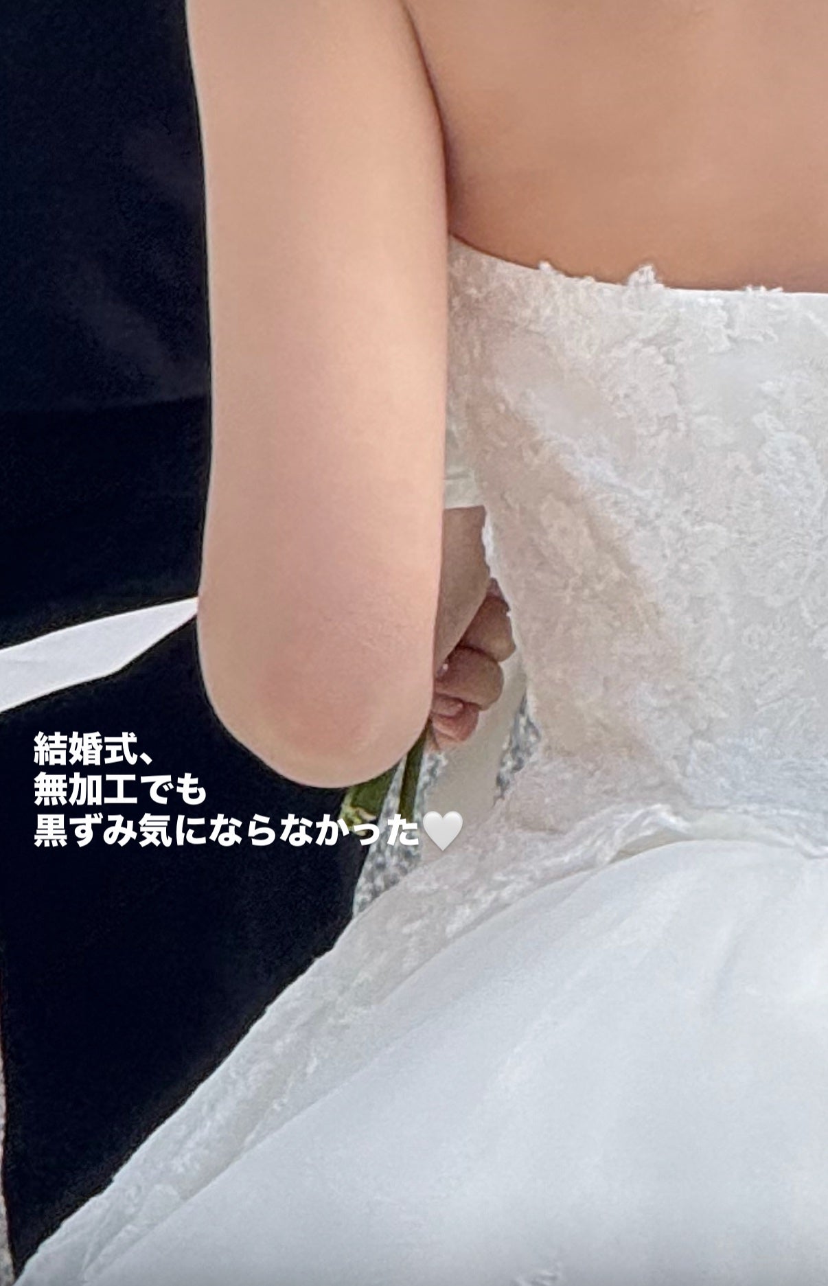 ナイアシンアミド 5% ボディローション/b.clinicx/ボディローションを使ったクチコミ(5枚目)