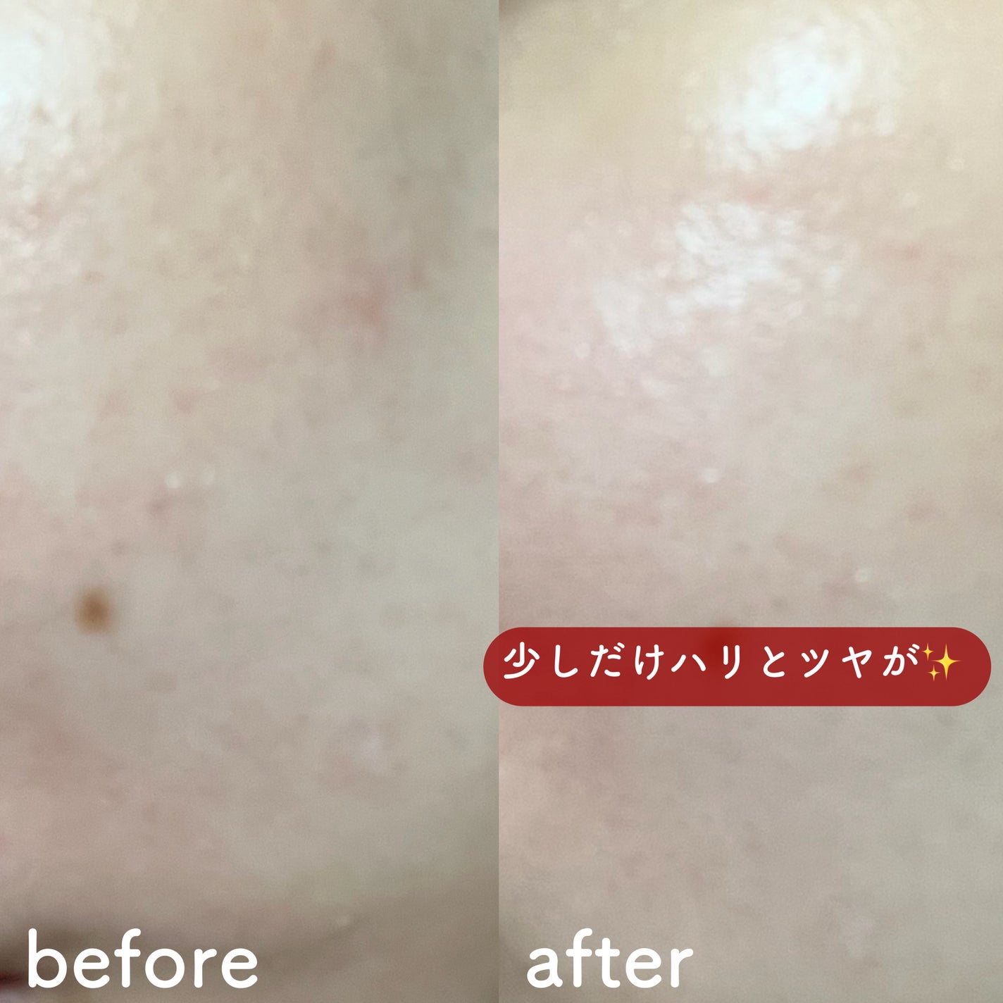 PDRN カプセルクリーム 100/VT/フェイスクリームを使ったクチコミ(6枚目)