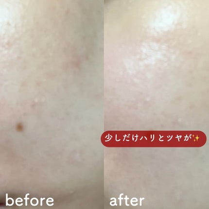 PDRN カプセルクリーム 100/VT/フェイスクリームを使ったクチコミ(6枚目)