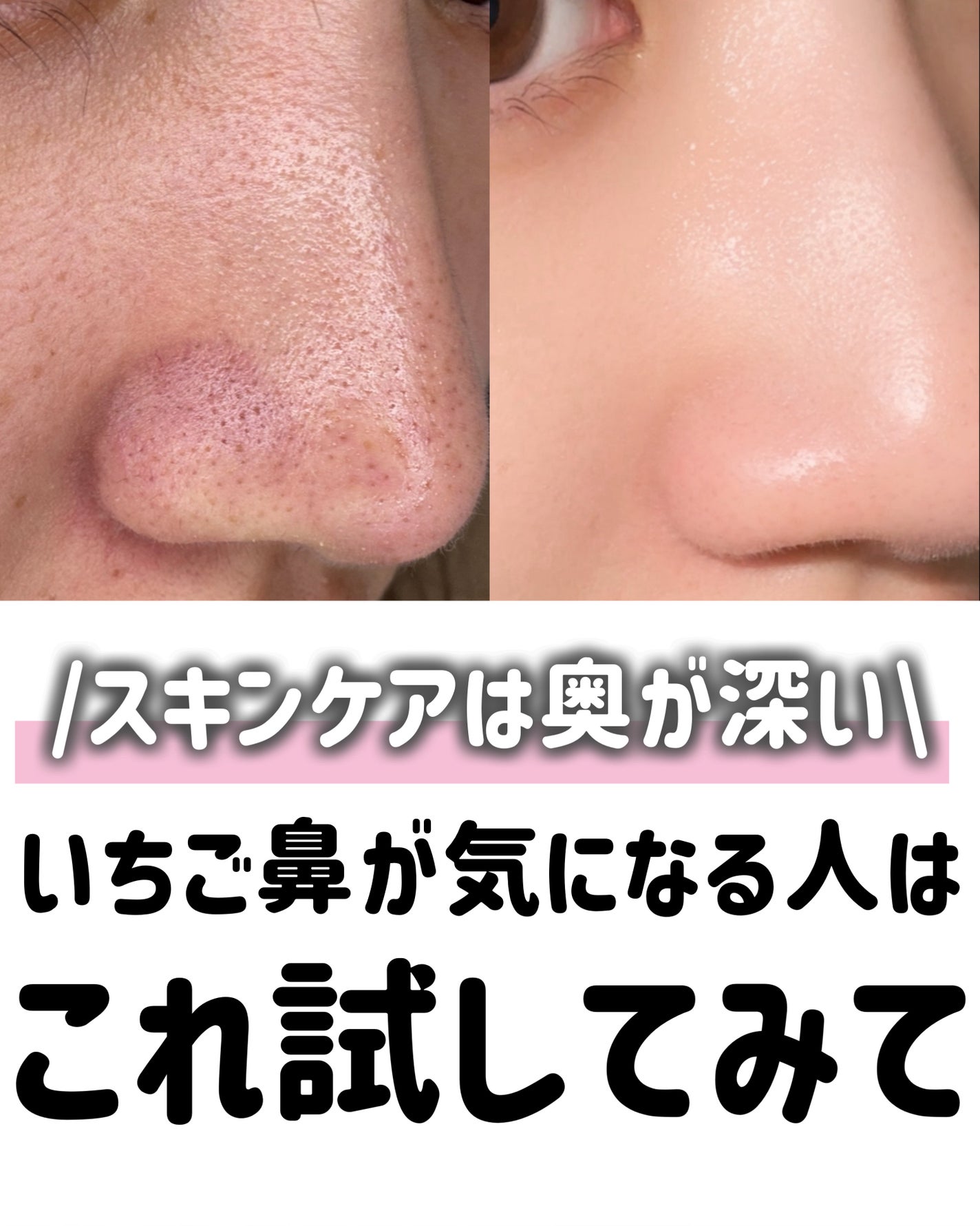 泥ジェル洗顔/ファンケル/その他洗顔料を使ったクチコミ(9枚目)