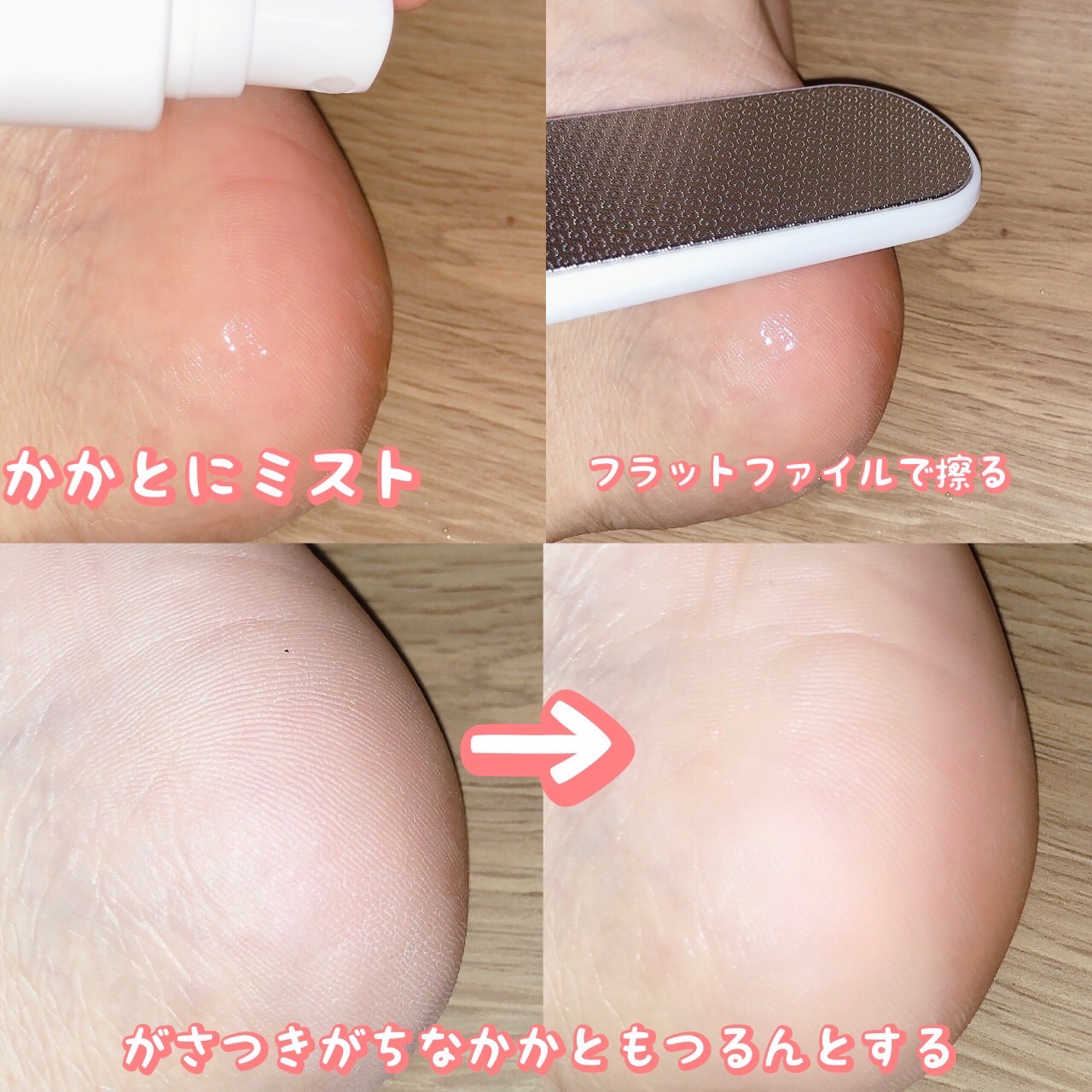 フットケアセット/BAREN/その他キットセットを使ったクチコミ（3枚目）