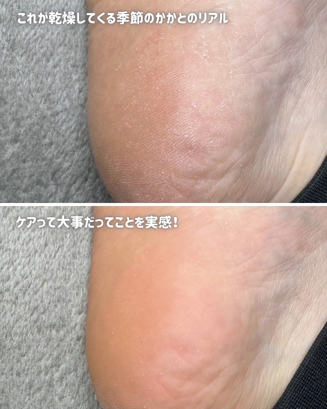 フットケアセット/BAREN/その他キットセットを使ったクチコミ(4枚目)