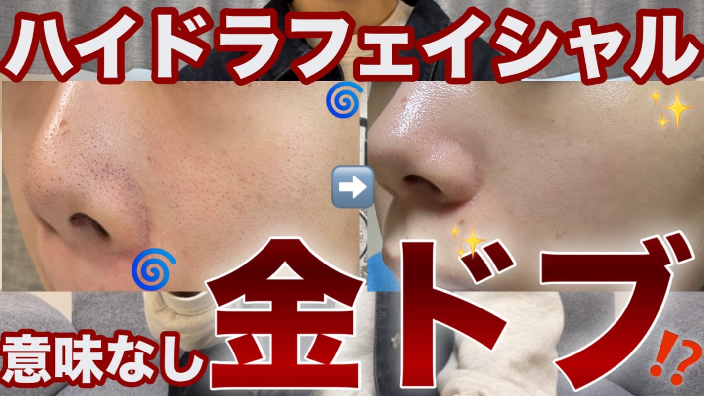 ãã¡ãð°ã¹ãã³ã±ã¢ããã on LIPS ãYouTubeå
¬éããŸããâ©.*Ë#çŸå®¹å»ç#çŸå®¹ç®èç§#ã¹ã..ãïŒ1æç®ïŒ