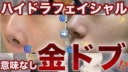 を使ったクチコミ(1枚目)