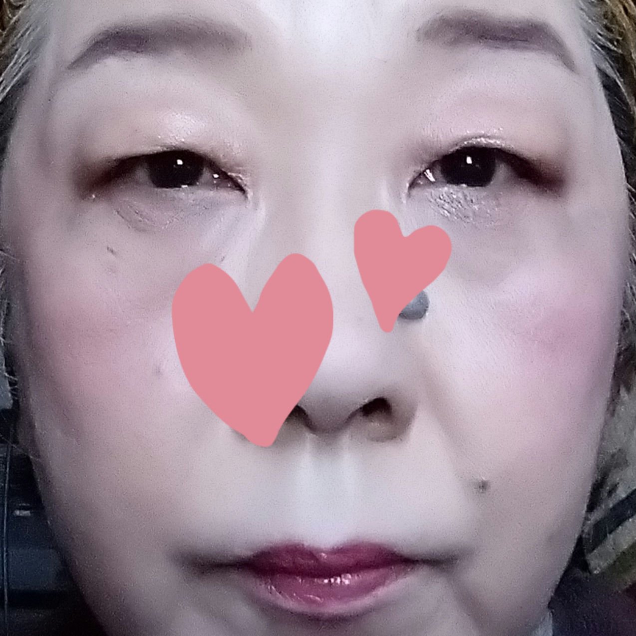 KM ライトタッチコンシーラー/DAISO/リキッドコンシーラーを使ったクチコミ（3枚目）