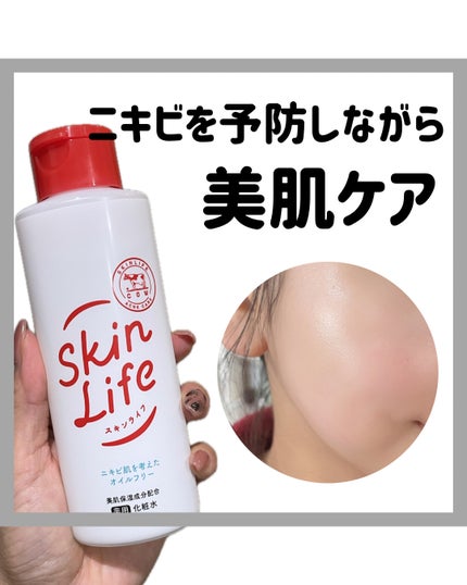 薬用化粧水/スキンライフ/化粧水を使ったクチコミ(1枚目)