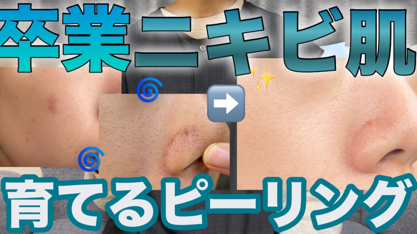 ãã¡ãð°ã¹ãã³ã±ã¢ããã on LIPS ãYouTubeåºããŸããâ©.*Ë#çŸå®¹ç®èç§#çŸå®¹å»ç#çŸå®¹#..ãïŒ1æç®ïŒ