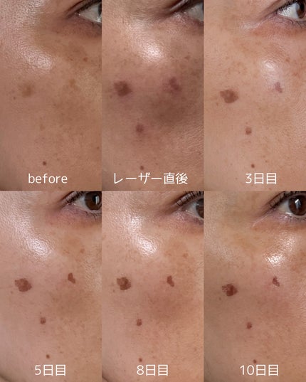 を使ったクチコミ(2枚目)