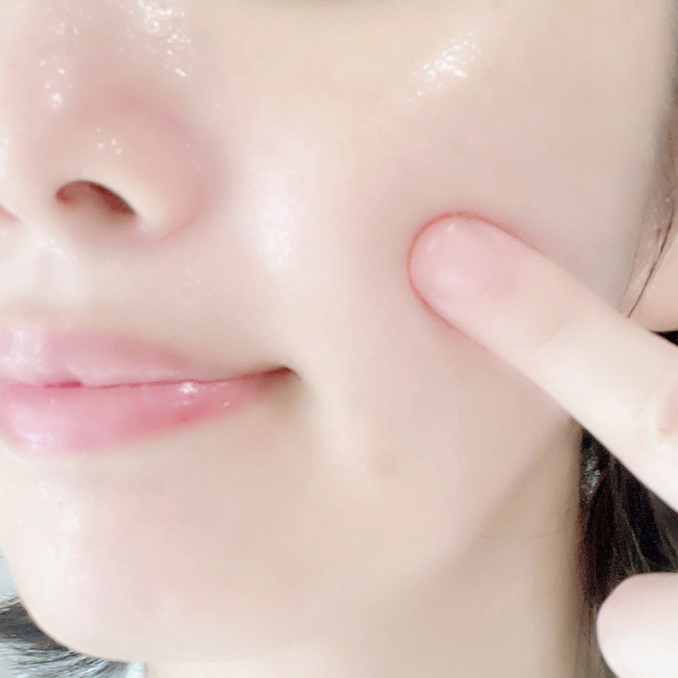 リードルS PDRN+ セラム/VT/美容液を使ったクチコミ(4枚目)