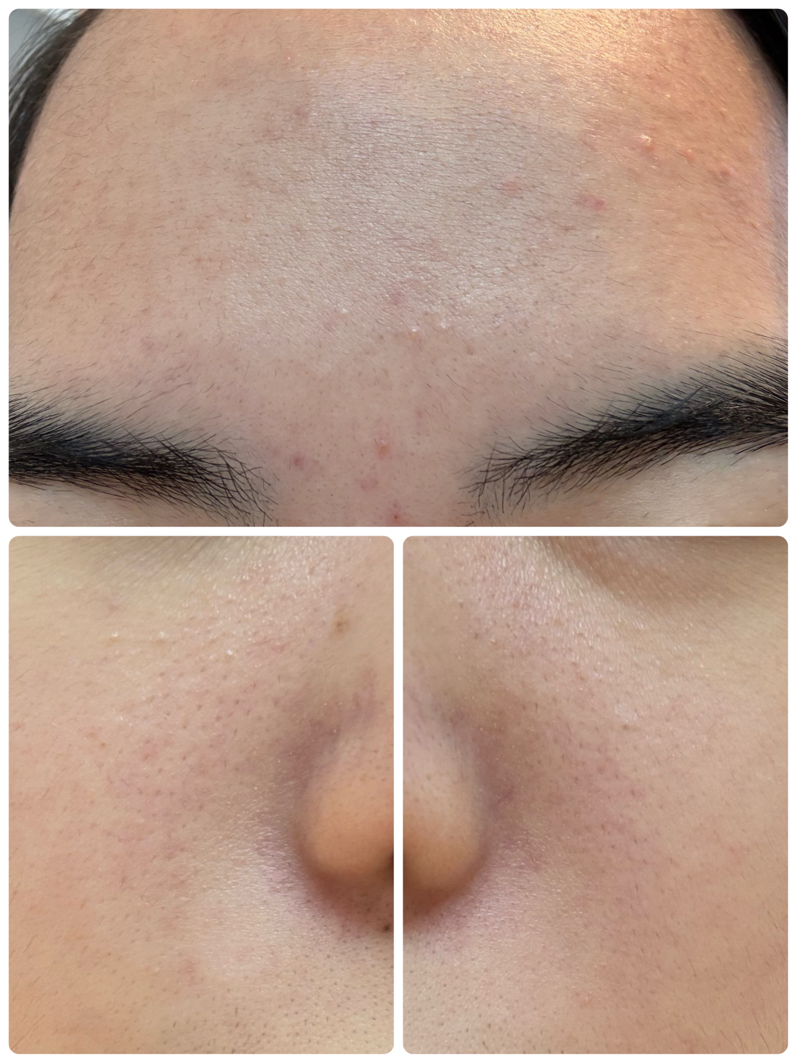 AGE-R ブースタープロ/MEDICUBE/美顔器・マッサージを使ったクチコミ（3枚目）