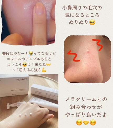 SOSメルダーシステム/KOPHER/フェイスクリームを使ったクチコミ(2枚目)
