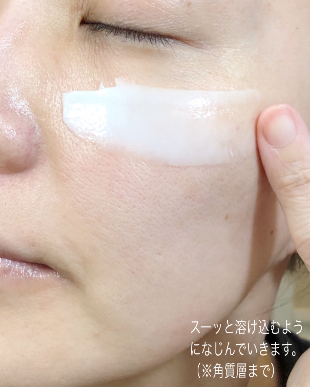 ウルトラ インテンシブクリーム/coeternal/フェイスクリームを使ったクチコミ（3枚目）