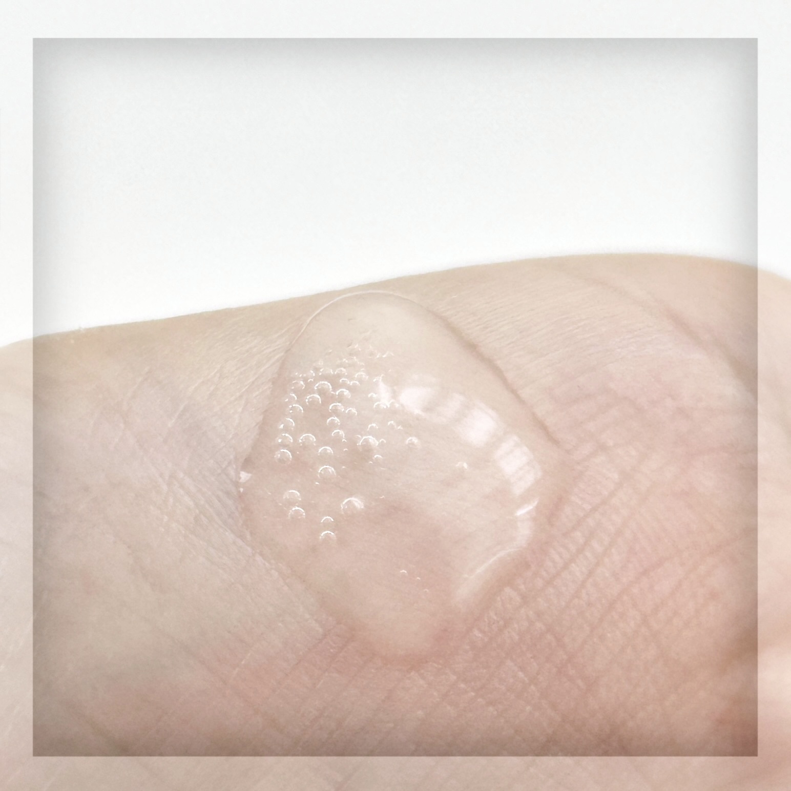 シナジーショットエディション/SAM'U/スキンケアキットを使ったクチコミ（3枚目）