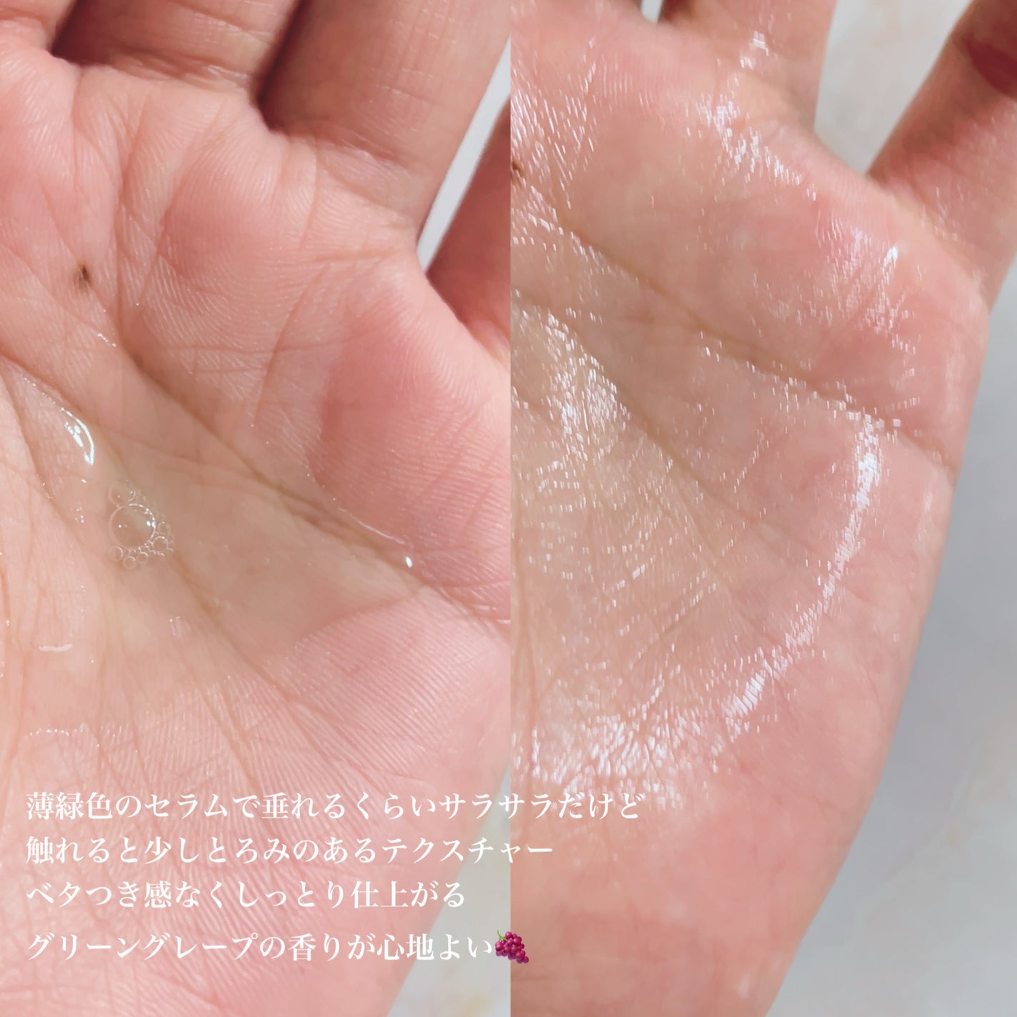 G3ナイアシンセラム/urbanand/美容液を使ったクチコミ(2枚目)