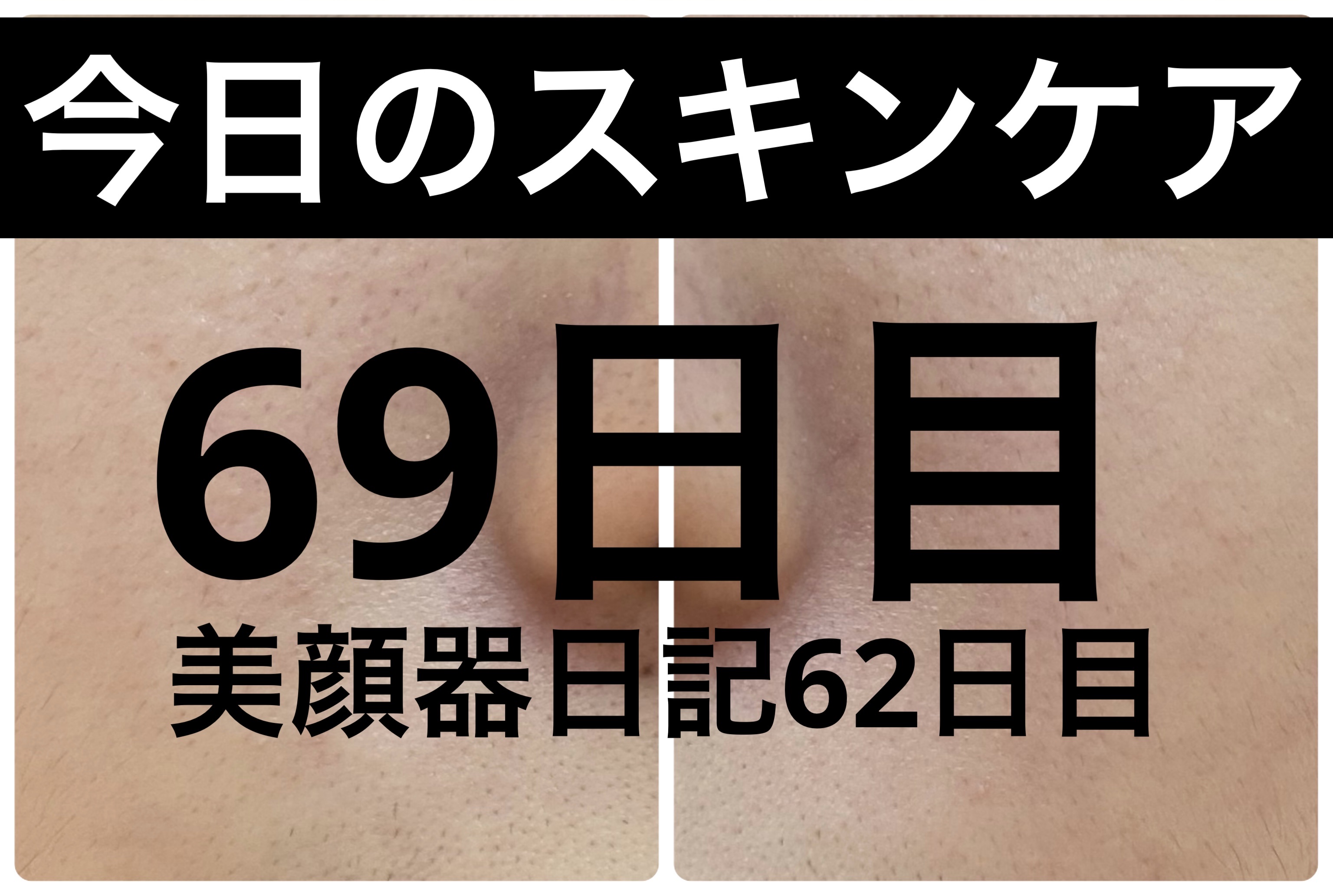 AGE-R ブースタープロ/MEDICUBE/美顔器・マッサージを使ったクチコミ（1枚目）