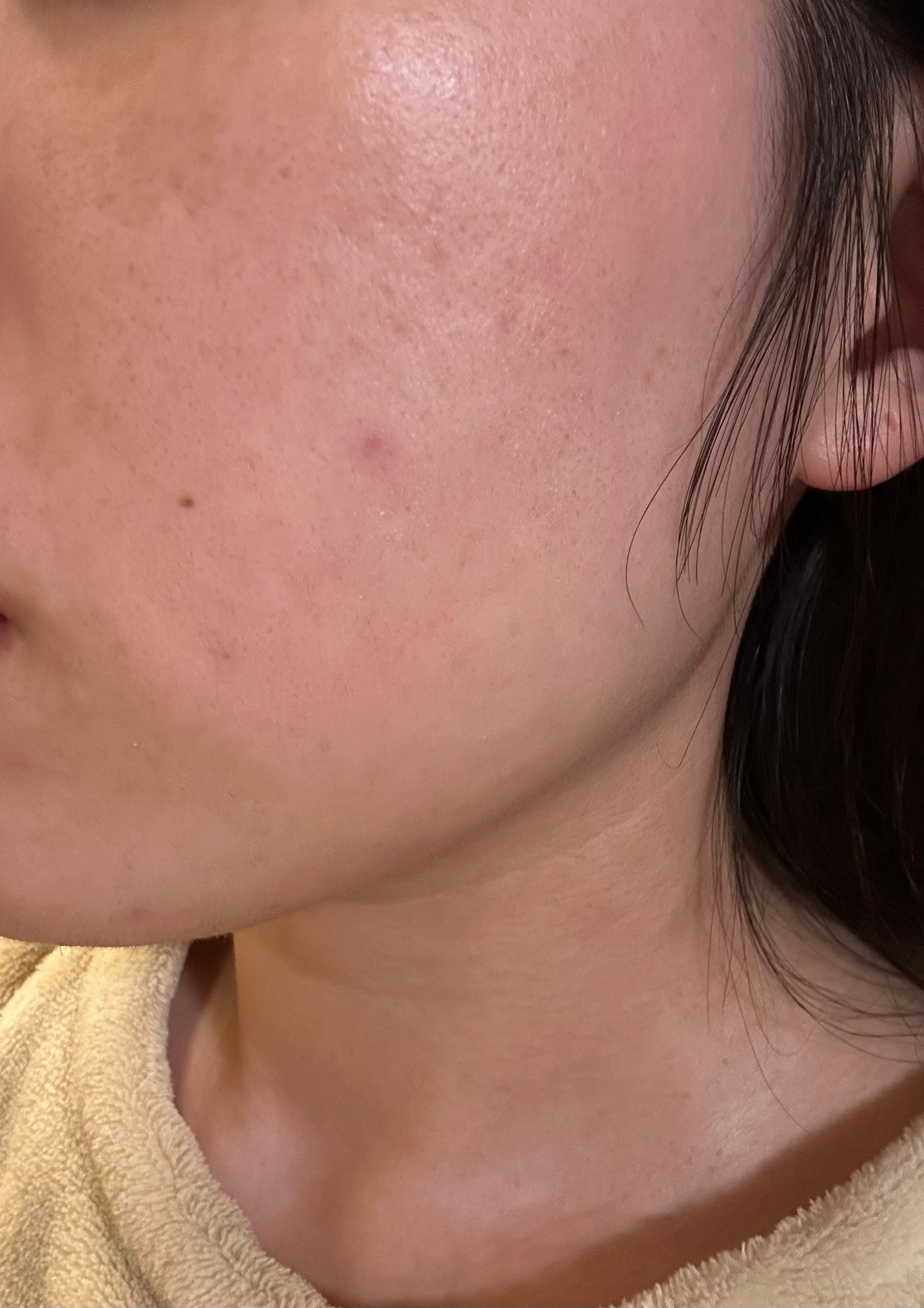 ミノン アミノモイスト モイストチャージ ミルク/ミノン/乳液を使ったクチコミ(4枚目)