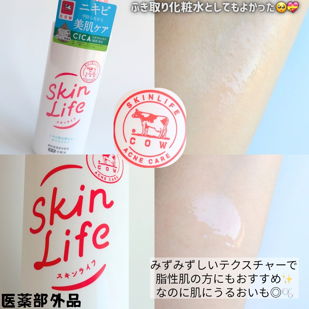 薬用化粧水/スキンライフ/化粧水を使ったクチコミ（2枚目）