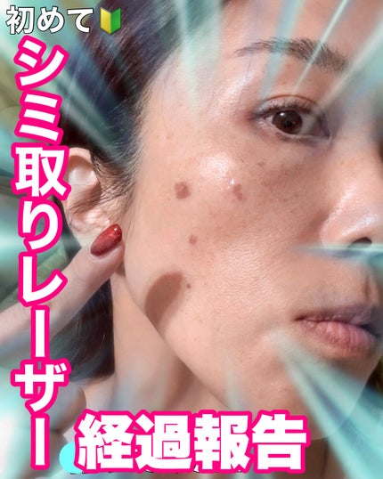 を使ったクチコミ(1枚目)