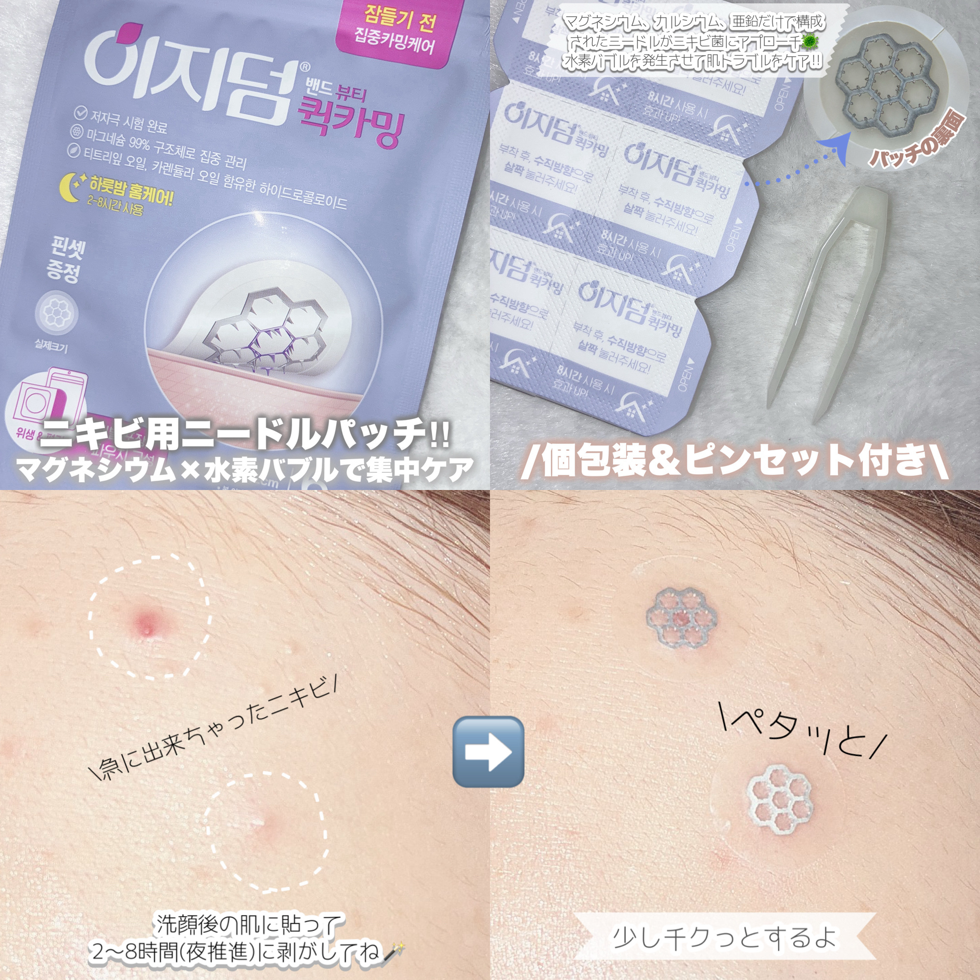 クイックカーミング パッチ/イージーダムビューティー/その他スキンケアを使ったクチコミ（2枚目）