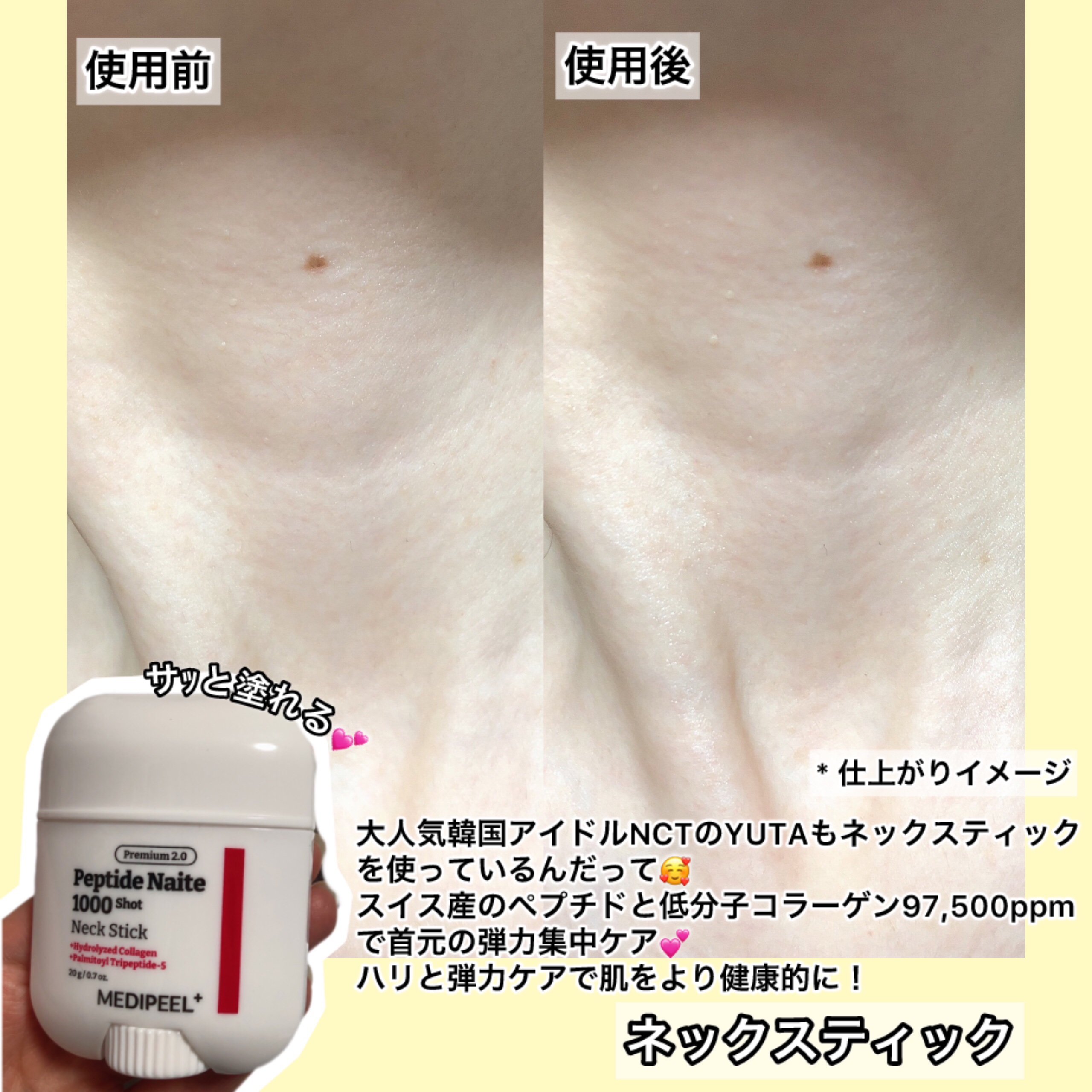 プレミアムナイテ スレッドネッククリーム/MEDIPEEL/ネック・デコルテケアを使ったクチコミ（3枚目）