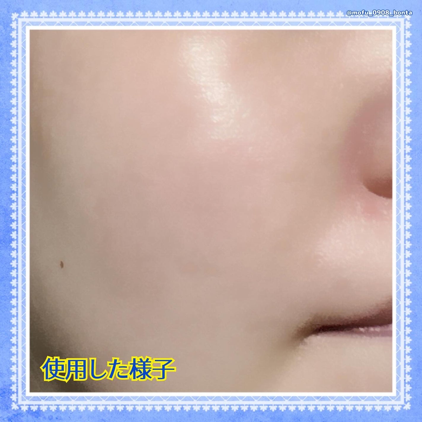 バデカシルDクリーム/23years old/フェイスクリームを使ったクチコミ(4枚目)