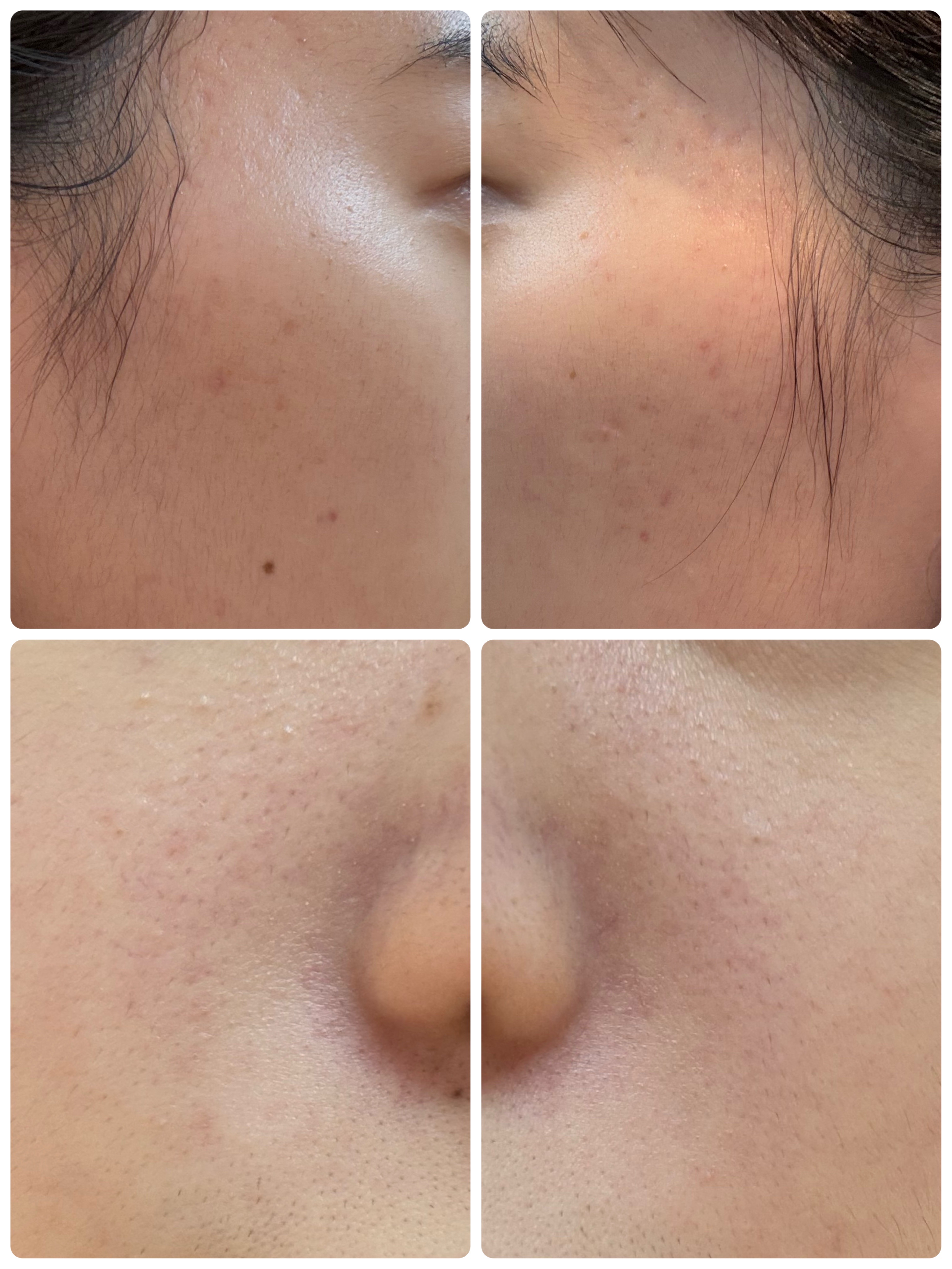 AGE-R ブースタープロ/MEDICUBE/美顔器・マッサージを使ったクチコミ（2枚目）